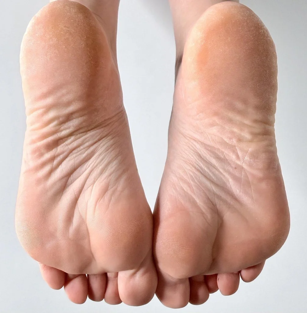 Độ dày lòng bàn chân